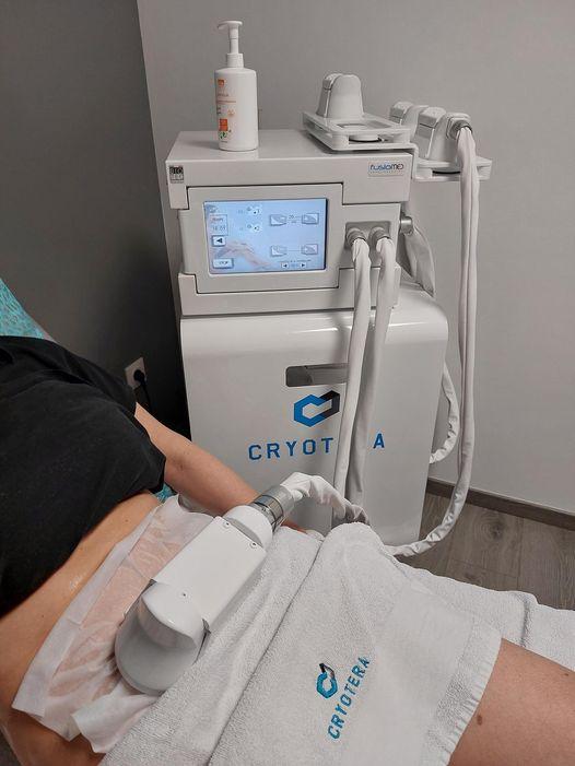 cryolipolyse